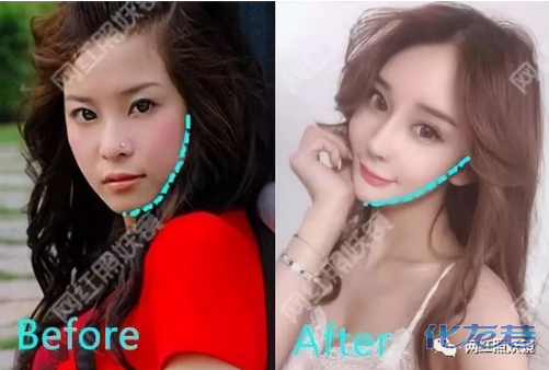 点击查看原图